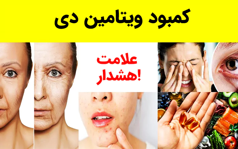 علائم کمبود ویتامین دی